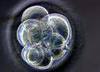 CELLULES SOUCHES
