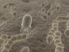 Nanoparticules contre le cancer